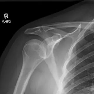 Case #6