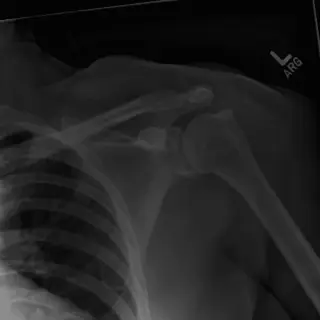 Case #7