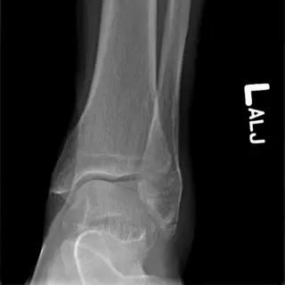 Case #8