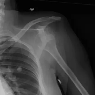 Case #8