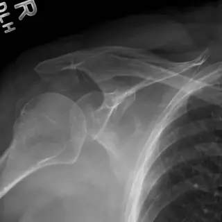 Case #9