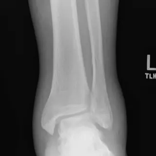 Case #1