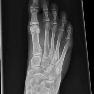 Case #10