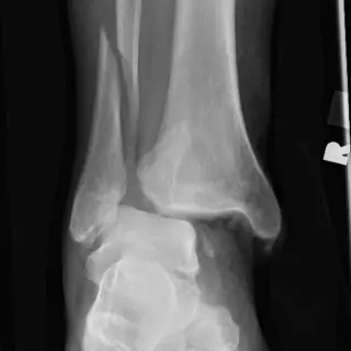 Case #2