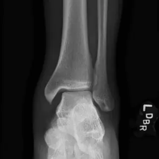 Case #3