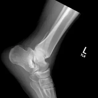 Case #4