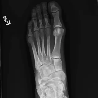 Case #6