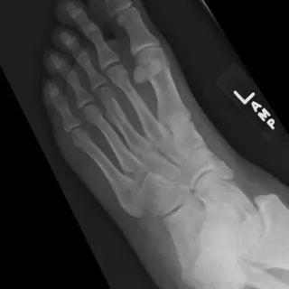 Case #7