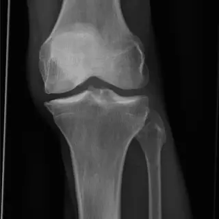 Case #7