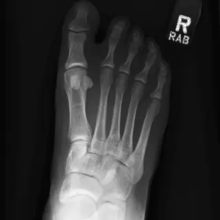 Case #9