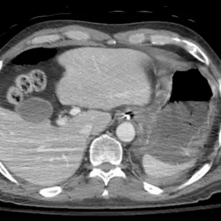 Case #9