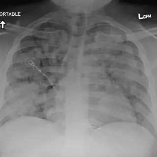 Case #16