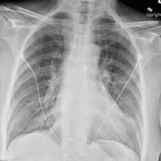 Case #4