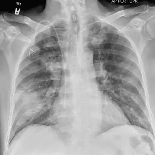 Case #5