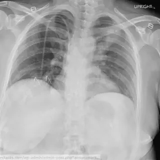 Case #6