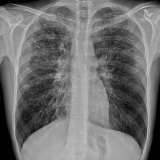 Case #7