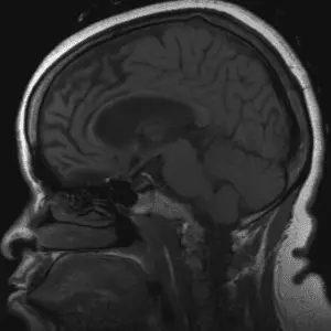 Caso #4