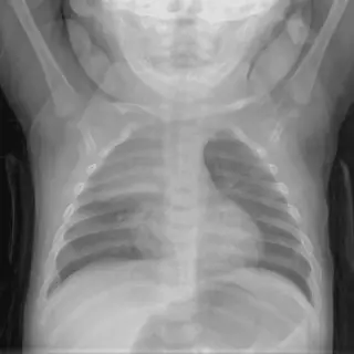 Case #9