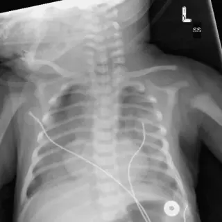 Case #9