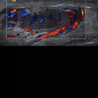 Case #14