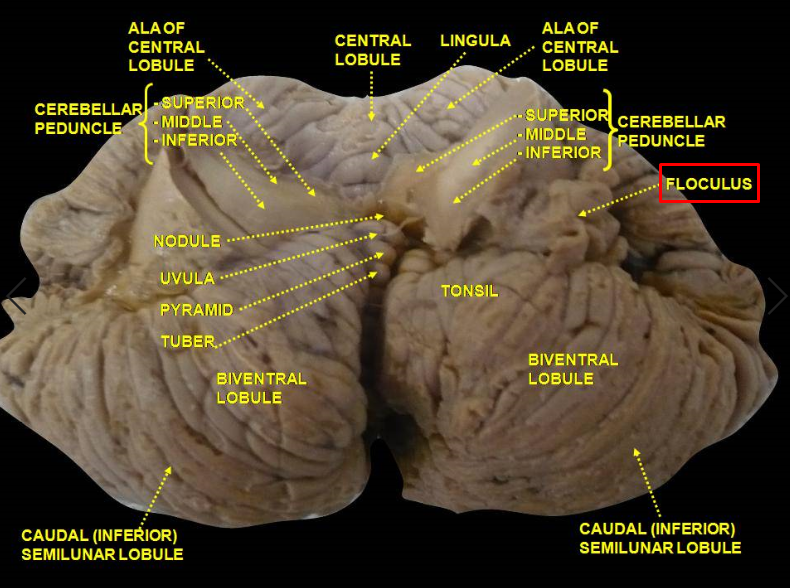 Flocculus