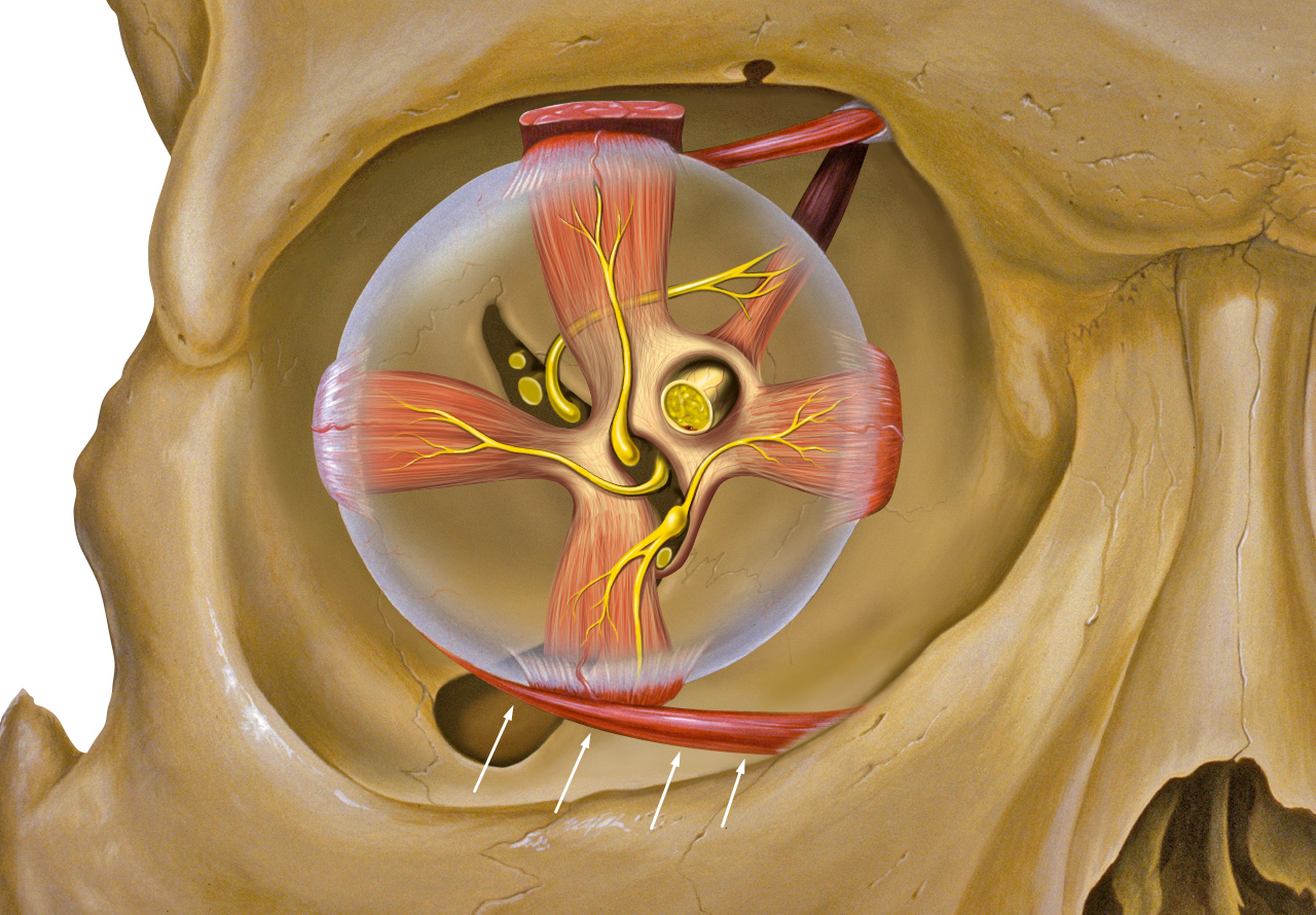 inferolateral oblique