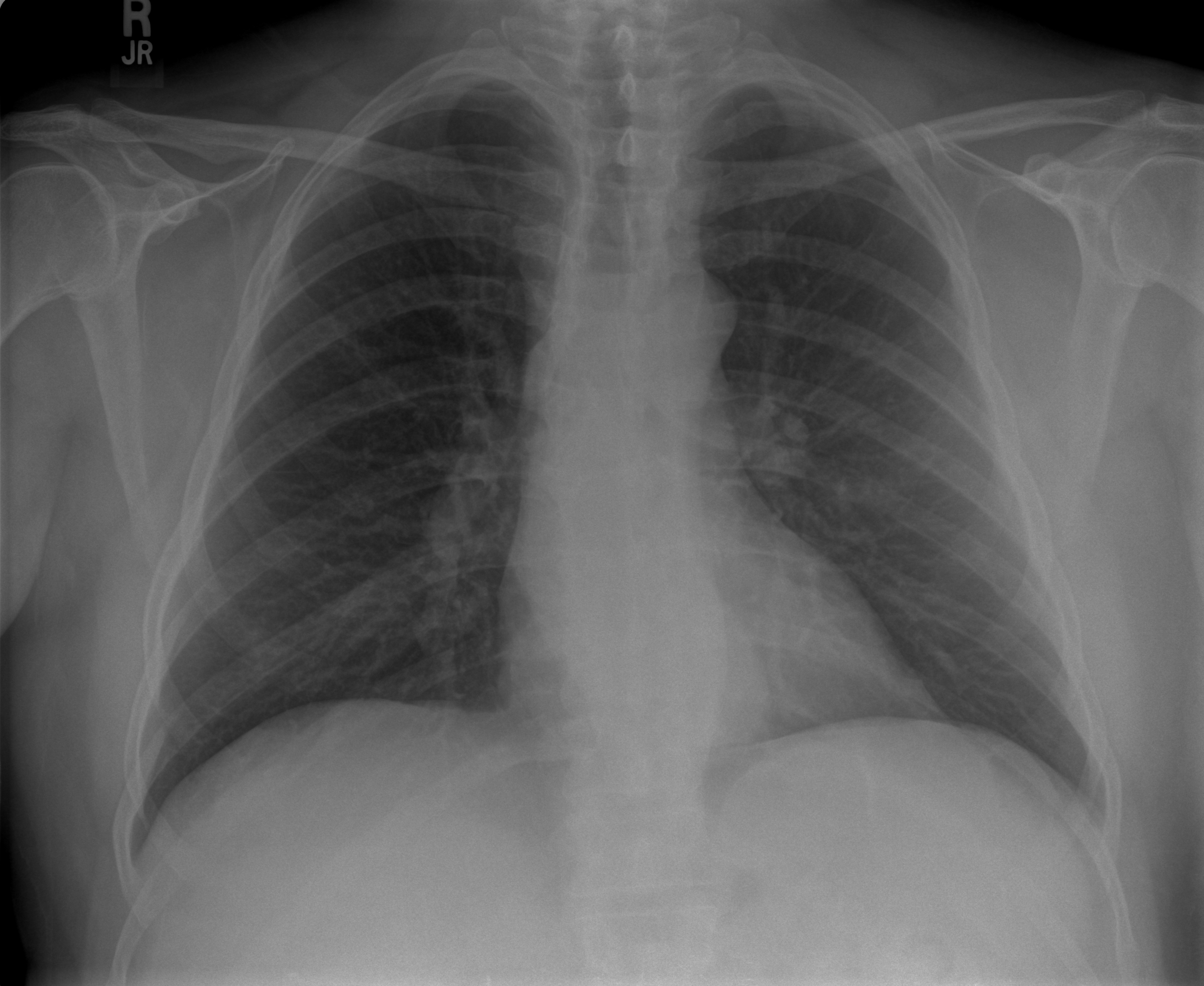 Chest Radiograph Workshop