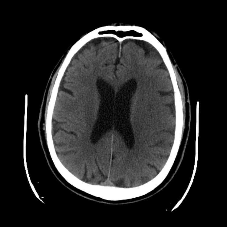 Case #3 Answers