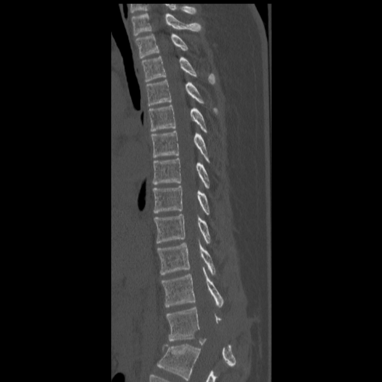 Case #22 - Casestacks.com