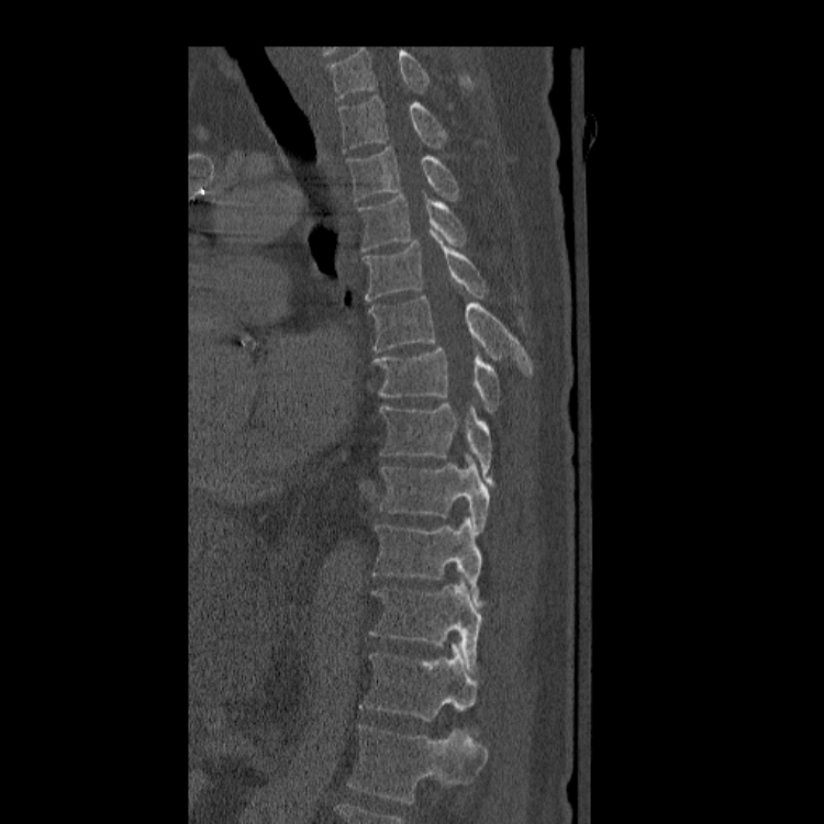 Case #21 - CaseStacks.com