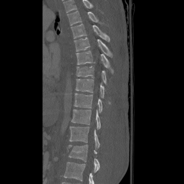 Case #19 - CaseStacks.com