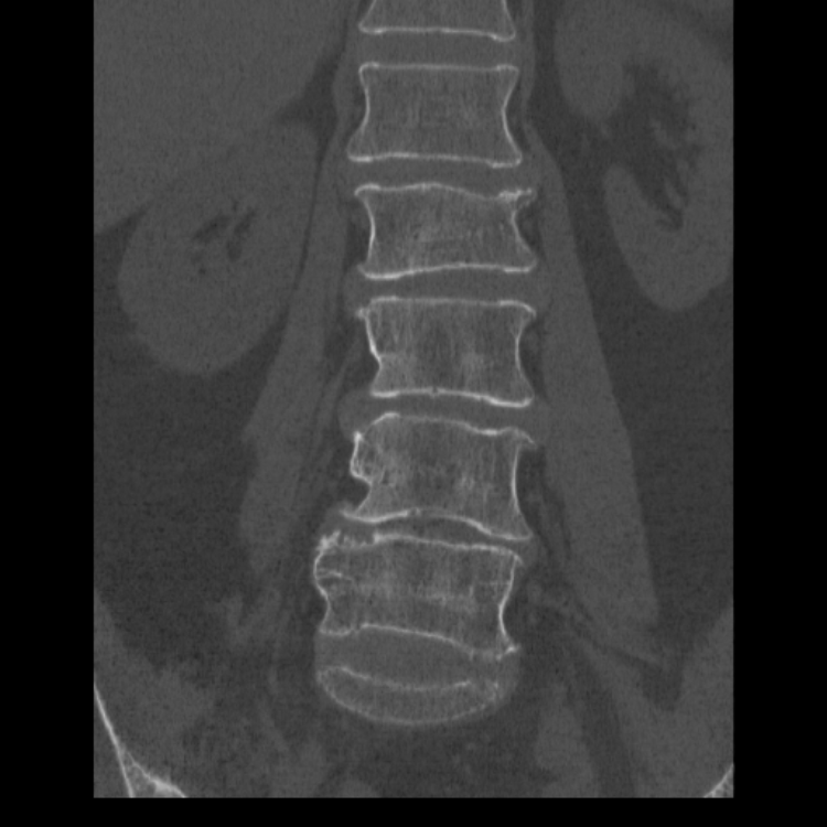 Case #28 - CaseStacks.com