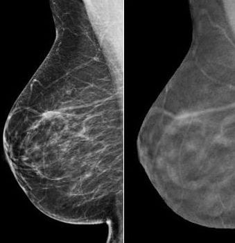 Women’s Imaging