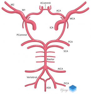 Circle of Willis