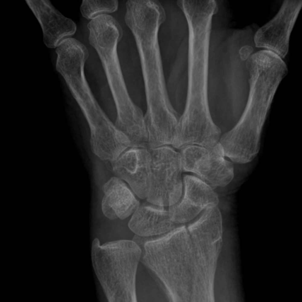 CaseStacks.com - MSK Radiograph Case #27