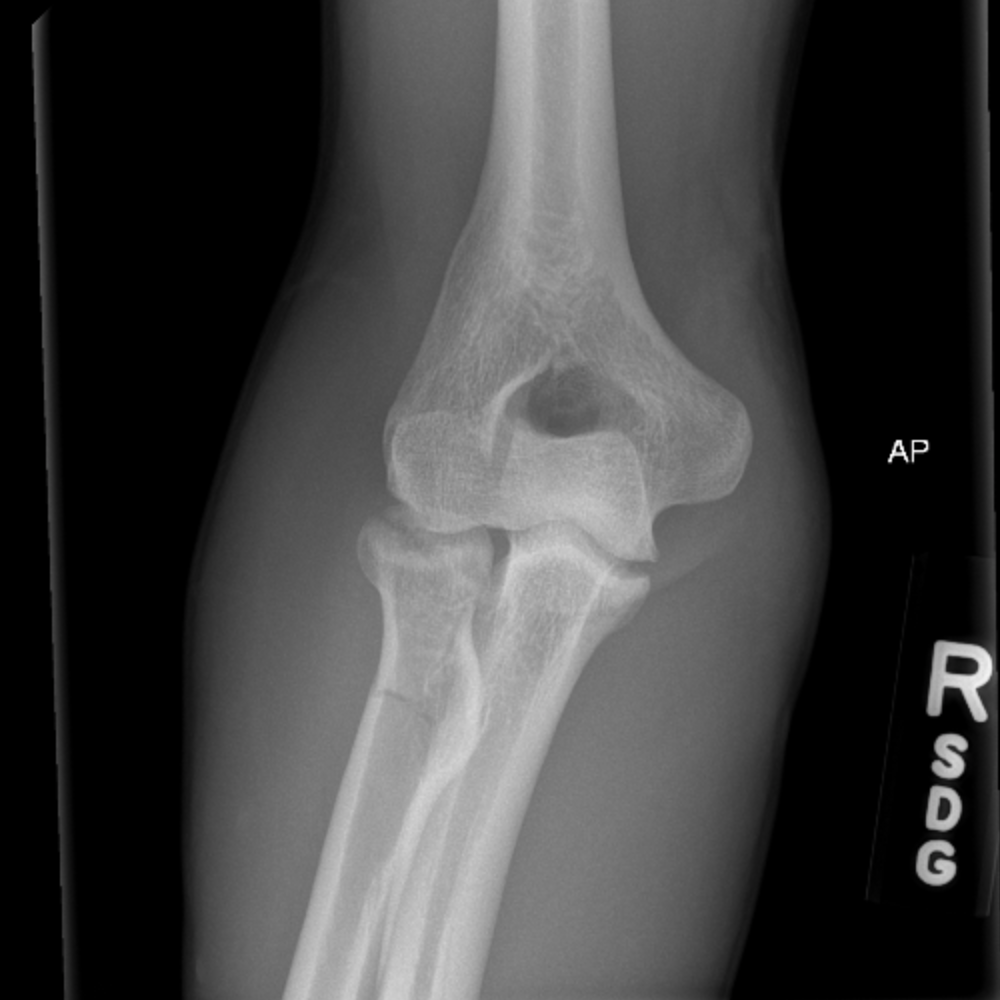 Casestacks.com - Msk Radiograph Case #30