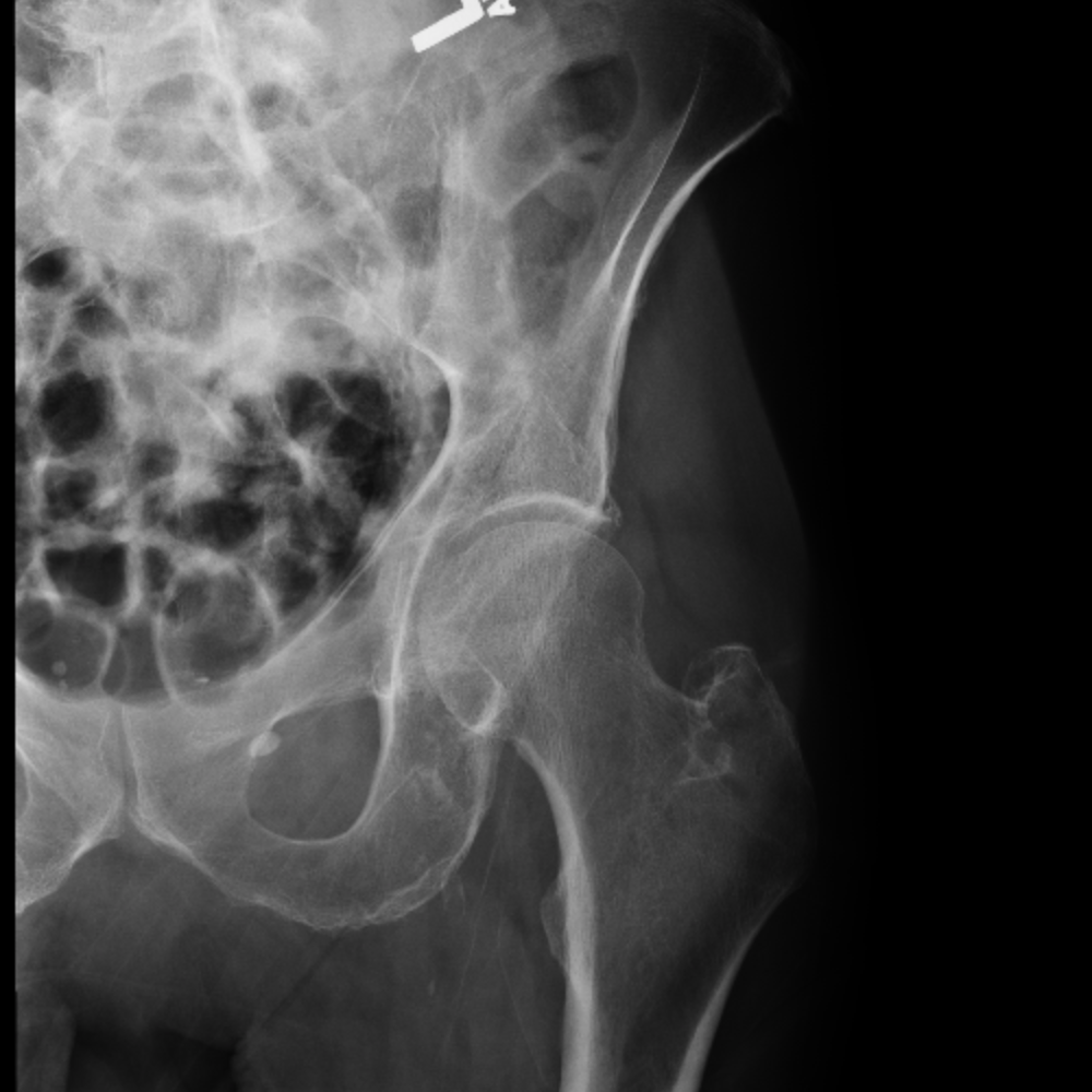 CaseStacks.com - MSK Radiograph Case #5