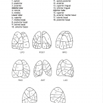 VQ lung segments: reference Sostman and Gottschalk.