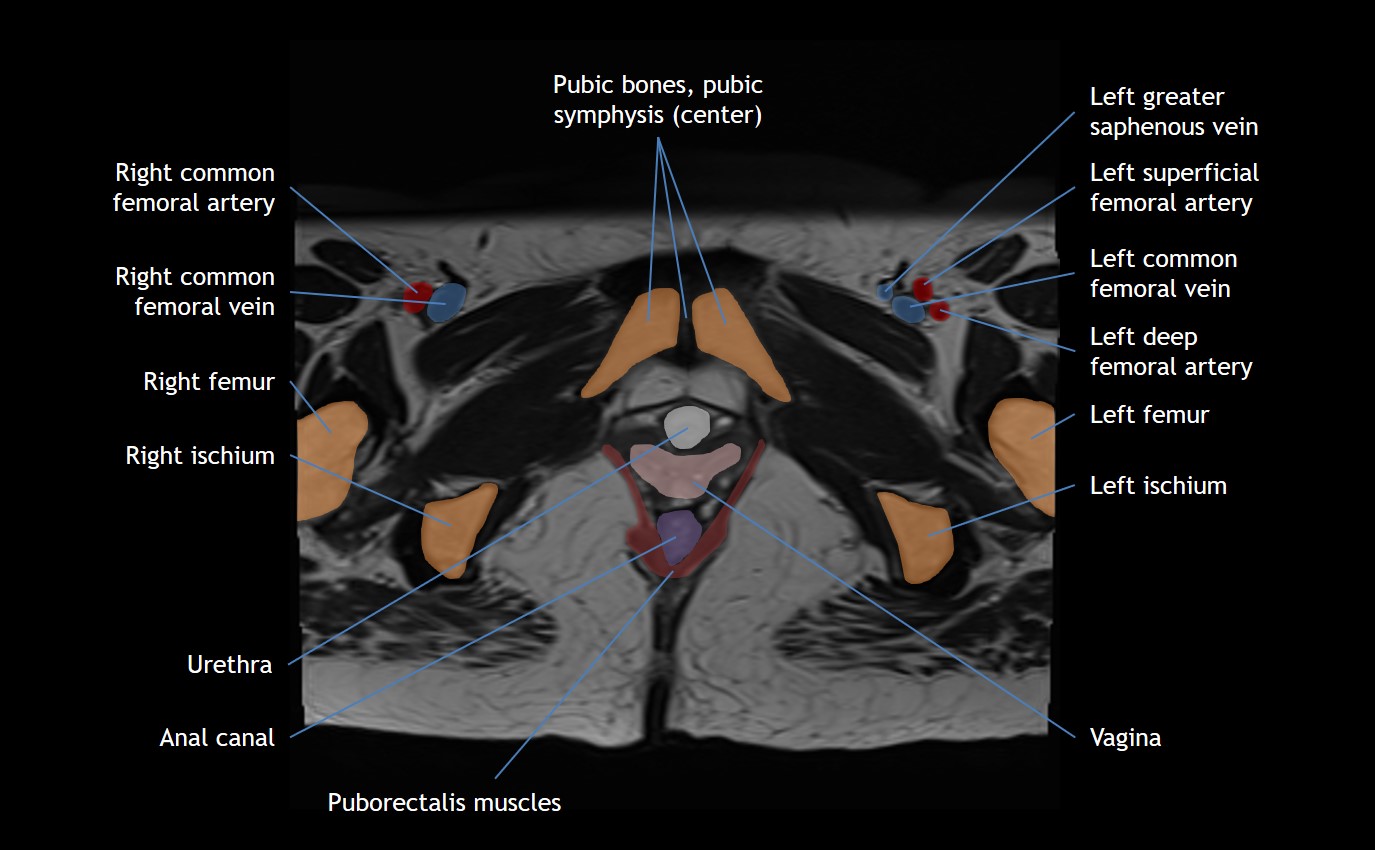 Pelvis Anatomy Module | CaseStacks.com