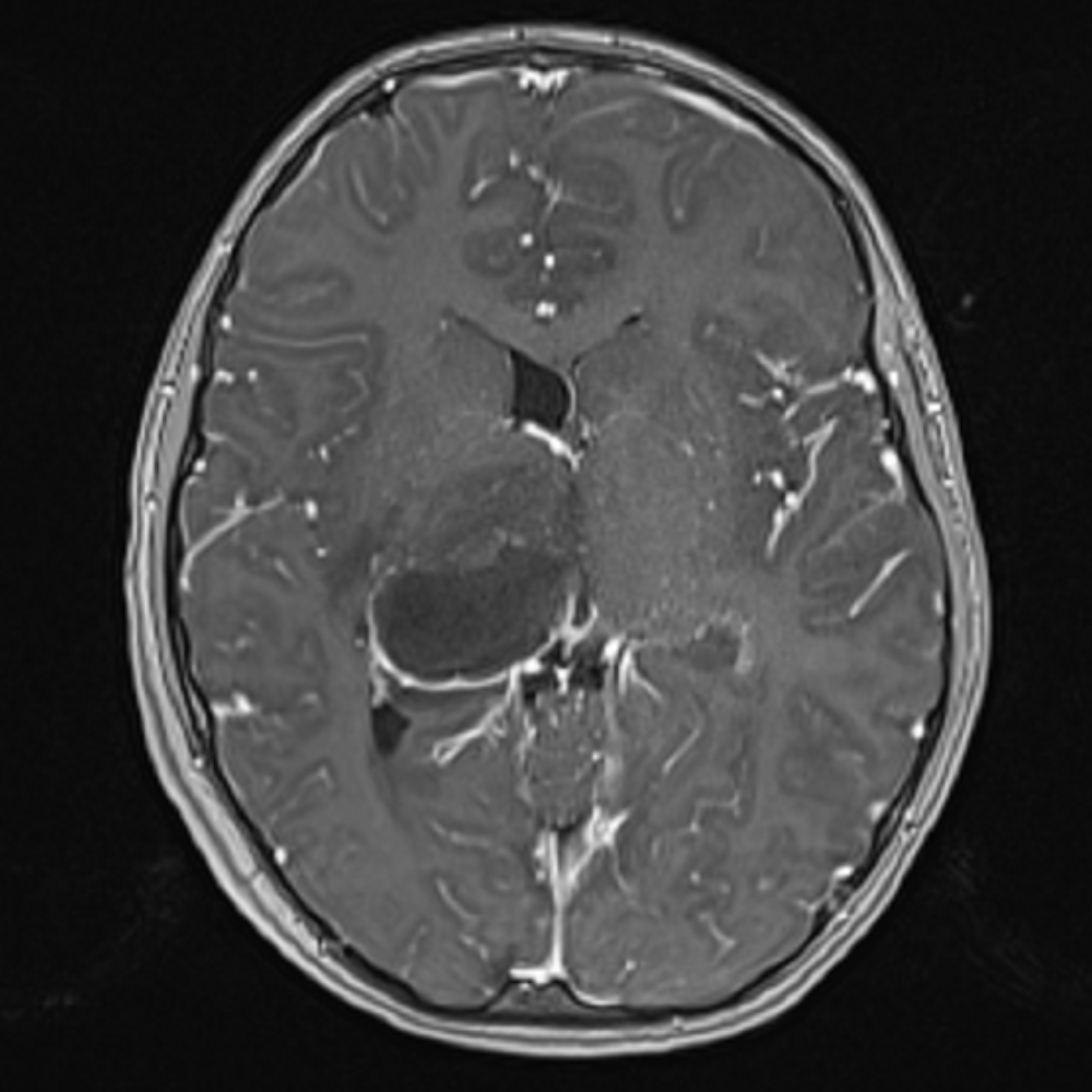 Case #36 - CaseStacks.com