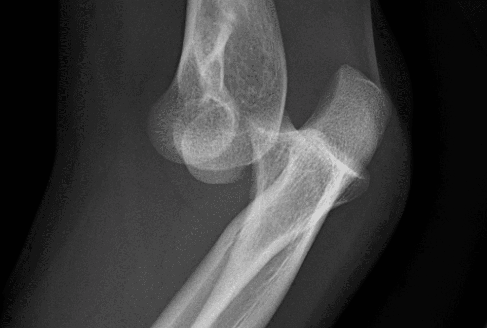 MSK – Elbow and Forearm Radiographs