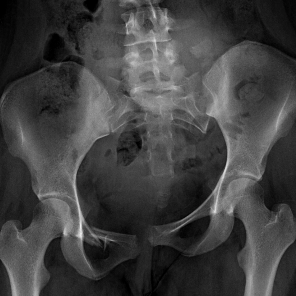 Casestacks.com - Interactive Pelvis & Hip Radiograph Cases