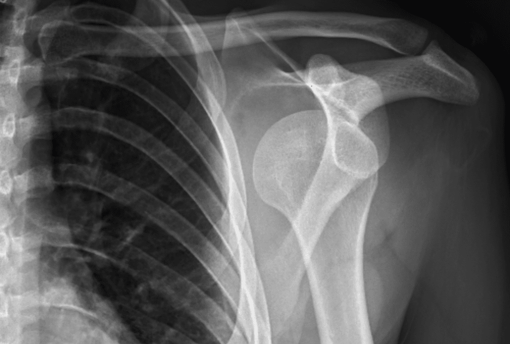 MSK Radiographs