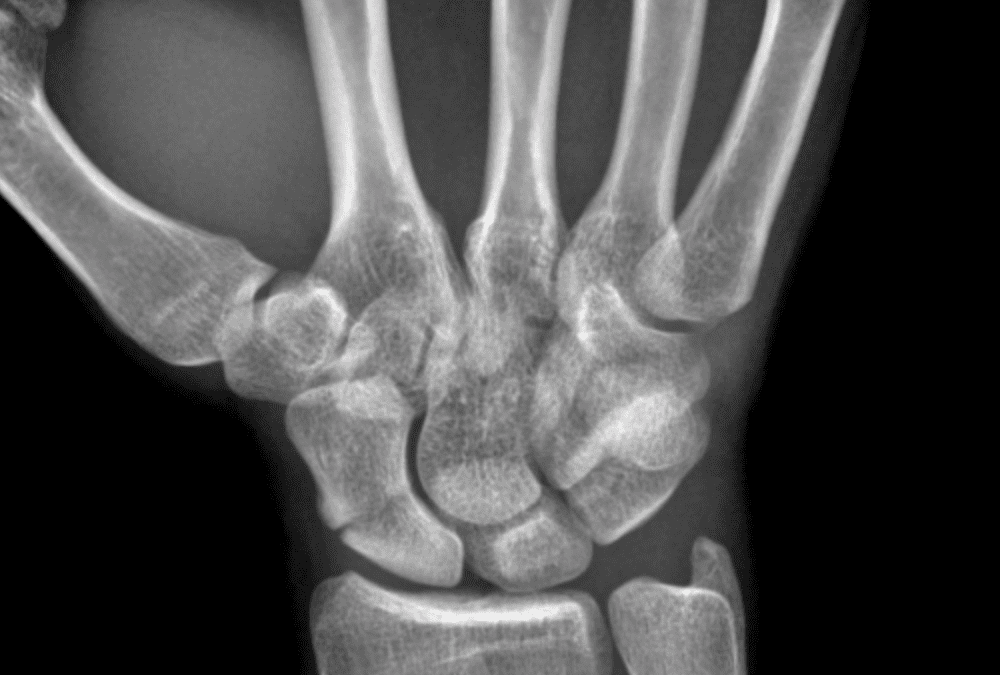 MSK – Wrist and Hand Radiographs