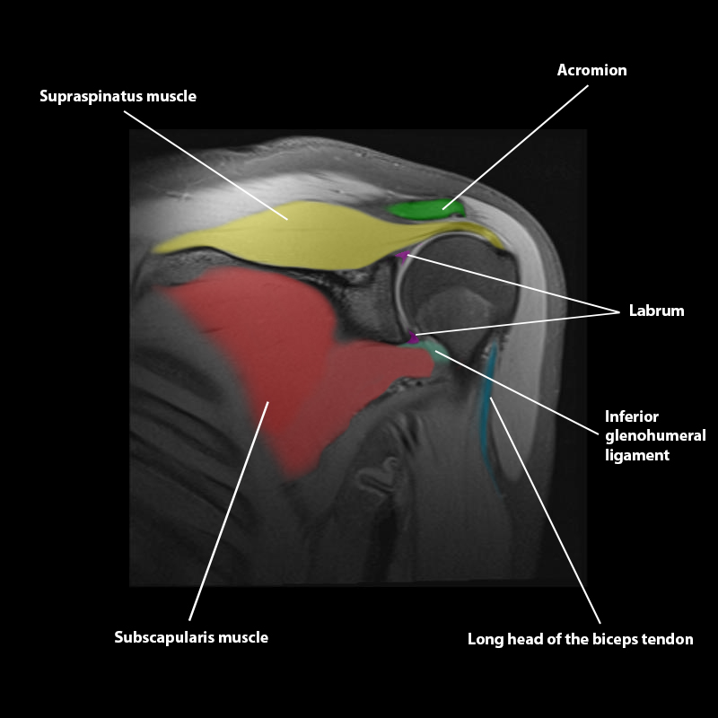 shoulder joint anatomy mri